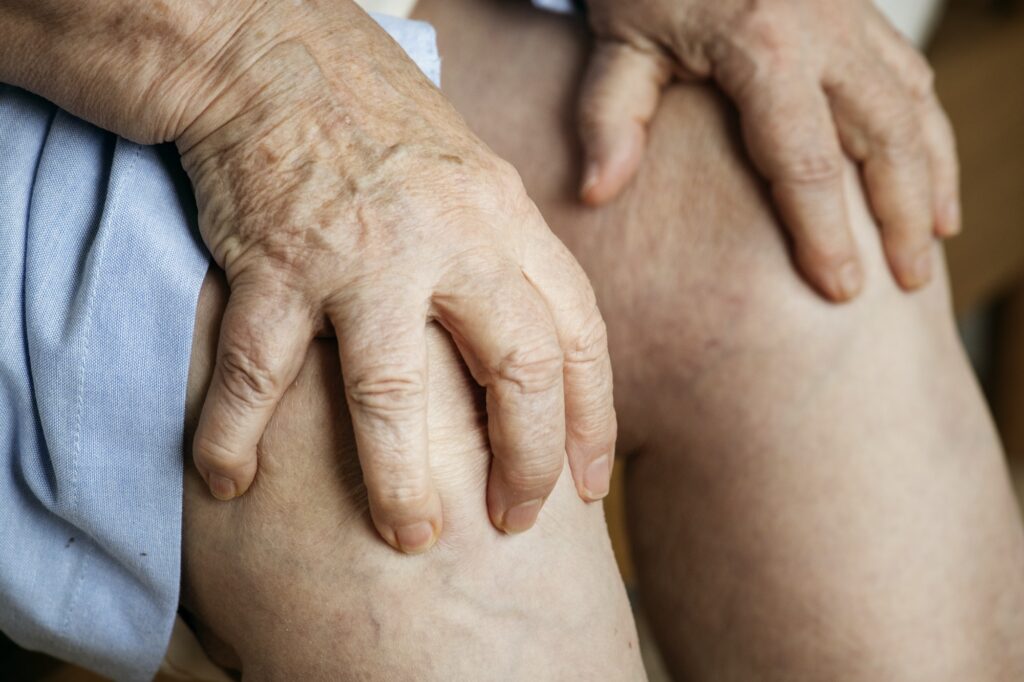 Mujer mayor con dolor de rodilla